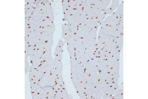 Immunohistochemistry of paraffin-embedded rat heart using Phospho-Chk1-S280 antibody (ABIN3019445, ABIN3019446, ABIN3019447 and ABIN6225372) at dilution of 1:100 (40x lens). (CHEK1 Antikörper  (pSer280))