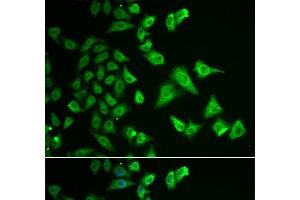 Immunofluorescence analysis of HeLa cells using DHRS2 Polyclonal Antibody (DHRS2 Antikörper)