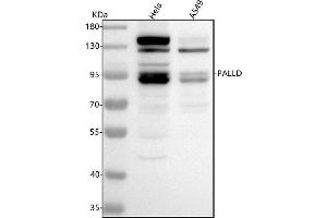 Western blot analysis of Palladin/PALLD using anti-Palladin/PALLD antibody (ABIN7602603).