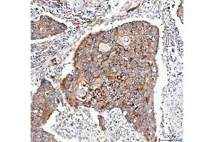 IHC analysis of Integrin alpha 3/ITGA3 using anti-Integrin alpha 3/ITGA3 antibody (ABIN7602696). (ITGA3 Antikörper  (AA 96-324))