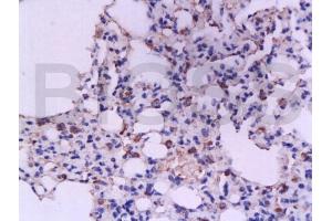 Formalin-fixed and paraffin embedded rat lung tissue labeled with Anti-IFN-gamma Polyclonal Antibody, Unconjugated (ABIN669126) at 1:200, followed by conjugation to the secondary antibody and DAB staining