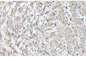 Immunohistochemistry of paraffin-embedded Human liver using Snail Polyclonal Antibody at dilution of 1:100 (40x lens). (SNAIL Antikörper)