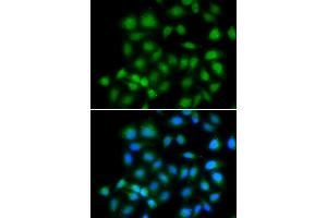 Immunofluorescence analysis of HeLa cells using MXI1 antibody. (MXI1 Antikörper)