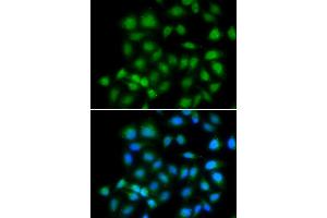 Immunofluorescence analysis of HeLa cells using MXI1 antibody. (MXI1 Antikörper)