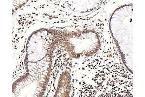 Immunohistochemistry analysis of paraffin-embedded human colon using LEP Polyclonal Antibody at dilution of 1:100. (Leptin Antikörper)