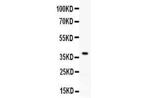 Western blot analysis of RANKL expression in rat brain extract ( Lane 1). (RANKL Antikörper  (AA 141-318))