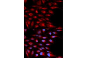Immunofluorescence (IF) image for anti-alpha-2-Glycoprotein 1, Zinc-Binding (AZGP1) antibody (ABIN1876553) (AZGP1 Antikörper)