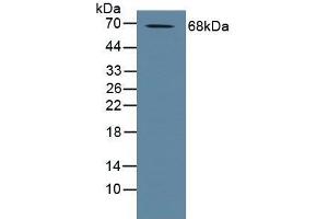 Detection of ADAM10 in Human Placenta Tissue using Polyclonal Antibody to A Disintegrin And Metalloprotease 10 (ADAM10)