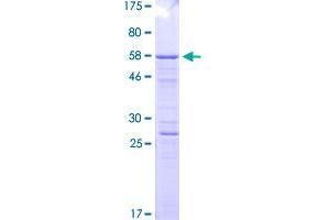 Image no. 1 for Transferrin Receptor (p90, CD71) (TFRC) (AA 89-760) protein (GST tag) (ABIN2566061)