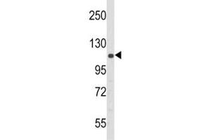 Western blot analysis of PERK antibody and 293 lysate (PERK Antikörper  (AA 148-175))