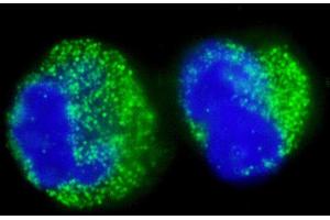 Immunofluorescence (IF) image for anti-Breakpoint Cluster Region (BCR) (AA 50-100) antibody (ABIN7453395)