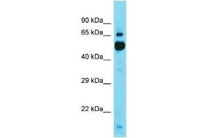 Western Blotting (WB) image for anti-Kelch Repeat and BTB (POZ) Domain Containing 11 (KBTBD11) (C-Term) antibody (ABIN2791602) (KBTBD11 Antikörper  (C-Term))