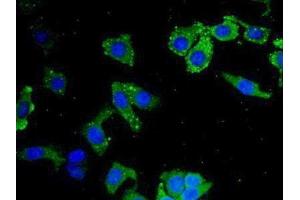 Detection of LEI in Human Hela Cell using Polyclonal Antibody to Leukocyte Elastase Inhibitor (LEI) (SERPINB1 Antikörper  (AA 184-368))