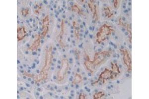 Detection of VEGFR2 in Rat Kidney Tissue using Polyclonal Antibody to Vascular Endothelial Growth Factor Receptor 2 (VEGFR2) (VEGFR2/CD309 Antikörper  (AA 46-320))