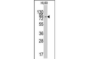 Western blot analysis of SLC16A1 polyclonal antibody  in HL-60 cell line lysates (35 ug/lane). (SLC16A1 Antikörper  (C-Term))