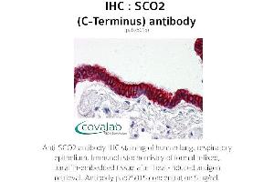 Image no. 2 for anti-SCO2 Cytochrome C Oxidase Assembly Protein (SCO2) antibody (ABIN1739069) (SCO2 Antikörper)