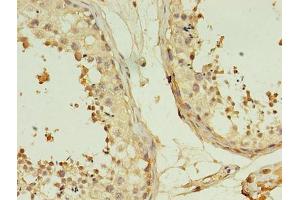 Immunohistochemistry of paraffin-embedded human testis tissue using ABIN7173059 at dilution of 1:100 (TMEM141 Antikörper  (AA 1-108))