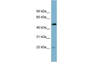 WB Suggested Anti-UCHL5IP  Antibody Titration: 0. (HAUS7 Antikörper  (Middle Region))