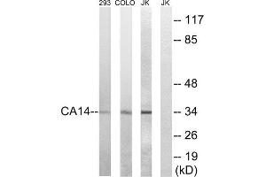 Western Blotting (WB) image for anti-Carbonic Anhydrase XIV (CA14) (Internal Region) antibody (ABIN1851004) (CA14 Antikörper  (Internal Region))