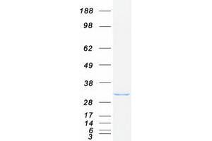 Western Blotting (WB) image for OTU Domain, Ubiquitin Aldehyde Binding 1 (OTUB1) (Transcript Variant 1) protein (Myc-DYKDDDDK Tag) (ABIN2728049)