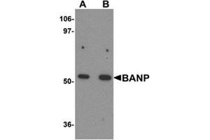 Western blot analysis of BANP in mouse kidney tissue lysate with BANP antibody at (A) 1 and (B) 2 μg/ml. (BANP Antikörper  (Center))