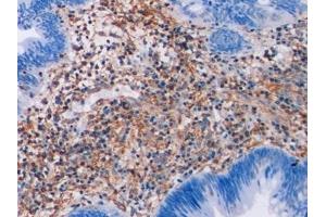 Immunohistochemistry (IHC) image for anti-Vimentin (VIM) antibody (ABIN7426163)