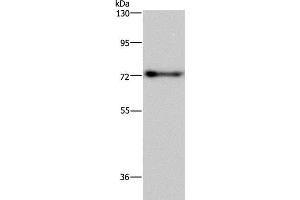 Western Blot analysis of Mouse brain tissue using PATZ1 Polyclonal Antibody at dilution of 1:250 (PATZ1 Antikörper)