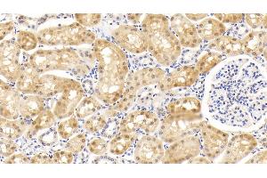 Detection of SOD1 in Bovine Kidney Tissue using Monoclonal Antibody to Superoxide Dismutase 1 (SOD1) (SOD1 Antikörper  (AA 2-152))