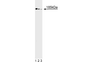 Western Blotting (WB) image for anti-Deleted in Colorectal Carcinoma (DCC) antibody (ABIN967443)
