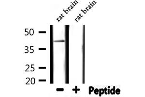 EPHX4 Antikörper  (Internal Region)