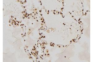 ABIN6264622 and ABIN6277666 at 1/100 staining Human lung tissue by IHC-P.