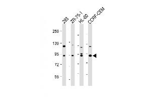 All lanes : Anti-P9 Antibody at 1:500-1:2000 dilution Lane 1: 293 whole cell lysate Lane 2: ZR-75-1 whole cell lysate Lane 3: HL-60 whole cell lysate Lane 4: CCRF-CEM whole cell lysate Lysates/proteins at 20 μg per lane. (MMP 9 Antikörper)
