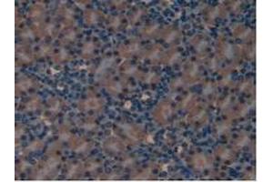 IHC-P analysis of Mouse Kidney Tissue, with DAB staining. (LIFR Antikörper  (AA 381-485))