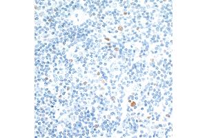 Immunohistochemistry (IHC) image for anti-V-Maf Musculoaponeurotic Fibrosarcoma Oncogene Homolog (Avian) (MAF) (AA 125-175) antibody (ABIN7455089) (Rekombinanter MAF Antikörper  (AA 125-175))