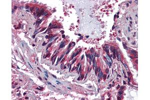 Anti-CCR3 antibody IHC of human lung, respiratory epithelium.