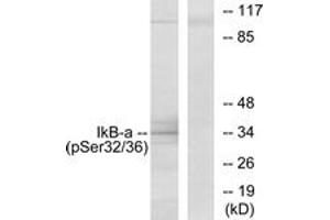 Western blot analysis of extracts from COS7 cells, using IkappaB-alpha (Phospho-Ser32/Ser36) Antibody.
