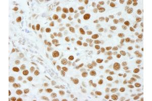 Immunohistochemistry (IHC) image for anti-5'-3' Exoribonuclease 2 (XRN2) (AA 900-950) antibody (ABIN7449038) (XRN2 Antikörper  (AA 900-950))