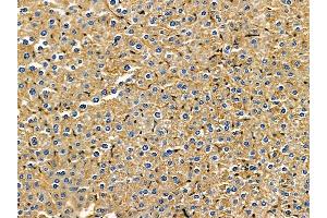 ABIN7095553 and ABIN7099610 at 1/100 staining mouse liver tissue by IHC-P.