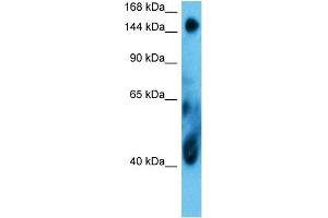 Host:  Rabbit  Target Name:  COIA1  Sample Type:  MCF7 Whole Cell  Antibody Dilution:  1. (COL18A1 Antikörper  (Middle Region))