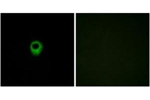 Immunofluorescence analysis of MCF7 cells, using EDG4 Antibody.