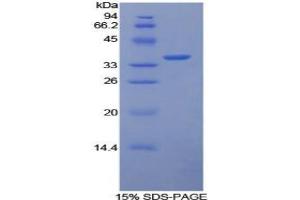 SDS-PAGE analysis of Rabbit Tissue Factor Protein. (Tissue factor Protein)