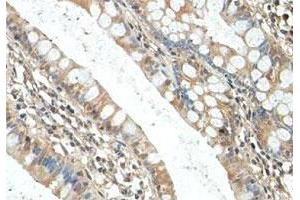 Immunohistochemical staining of formalin-fixed paraffin-embedded human fetal small intestine tissue showing cytoplasmic staining with RICTOR polyclonal antibody  at 1 : 100 dilution. (RICTOR Antikörper  (AA 1406-1700))