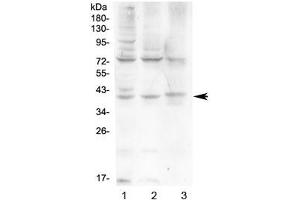 Western blot testing of human 1) HeLa, 2) HepG2 and 3) A431 cell lysate with HFE antibody at 0. (HFE Antikörper)