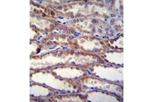 Formalin fixed, paraffin embedded human kidney tissue stained with SHISA3 Antibody (C-term) followed by peroxidase conjugation of the secondary antibody and DAB staining. (SHISA3 Antikörper  (C-Term))