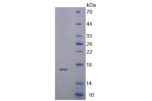 Image no. 1 for D-Dopachrome Tautomerase (DDT) (AA 2-118) protein (His tag) (ABIN6237008) (DDT Protein (AA 2-118) (His tag))