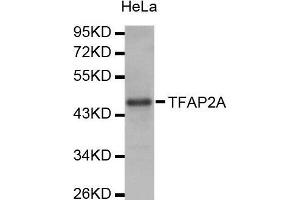 Western Blotting (WB) image for anti-Transcription Factor AP-2 alpha (Activating Enhancer Binding Protein 2 Alpha) (TFAP2A) (AA 1-437) antibody (ABIN1678679) (TFAP2A Antikörper  (AA 1-437))