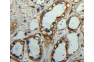 Used in DAB staining on fromalin fixed paraffin-embedded kidney tissue (C1QBP Antikörper  (AA 72-279))