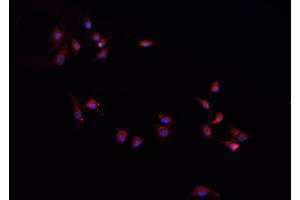 Immunofluorescence (fixed cells) (IF/ICC) image for anti-Chemokine (C-X-C Motif) Ligand 1 (Melanoma Growth Stimulating Activity, Alpha) (CXCL1) (Internal Region) antibody (ABIN6262095)