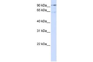 Western Blotting (WB) image for anti-Discs, Large (Drosophila) Homolog-Associated Protein 5 (DLGAP5) antibody (ABIN2458993) (DLGAP5 Antikörper)