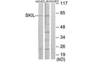 Western Blotting (WB) image for anti-SKI-Like Oncogene (SKIL) (AA 616-665) antibody (ABIN2889392) (SKIL Antikörper  (AA 616-665))